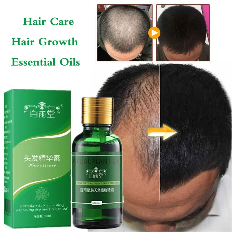 

Hair Growth Essential Oils Essence Anti Hair Loss Products Health Care Beauty Faster Grow Dense Hair Care Liquid Serum