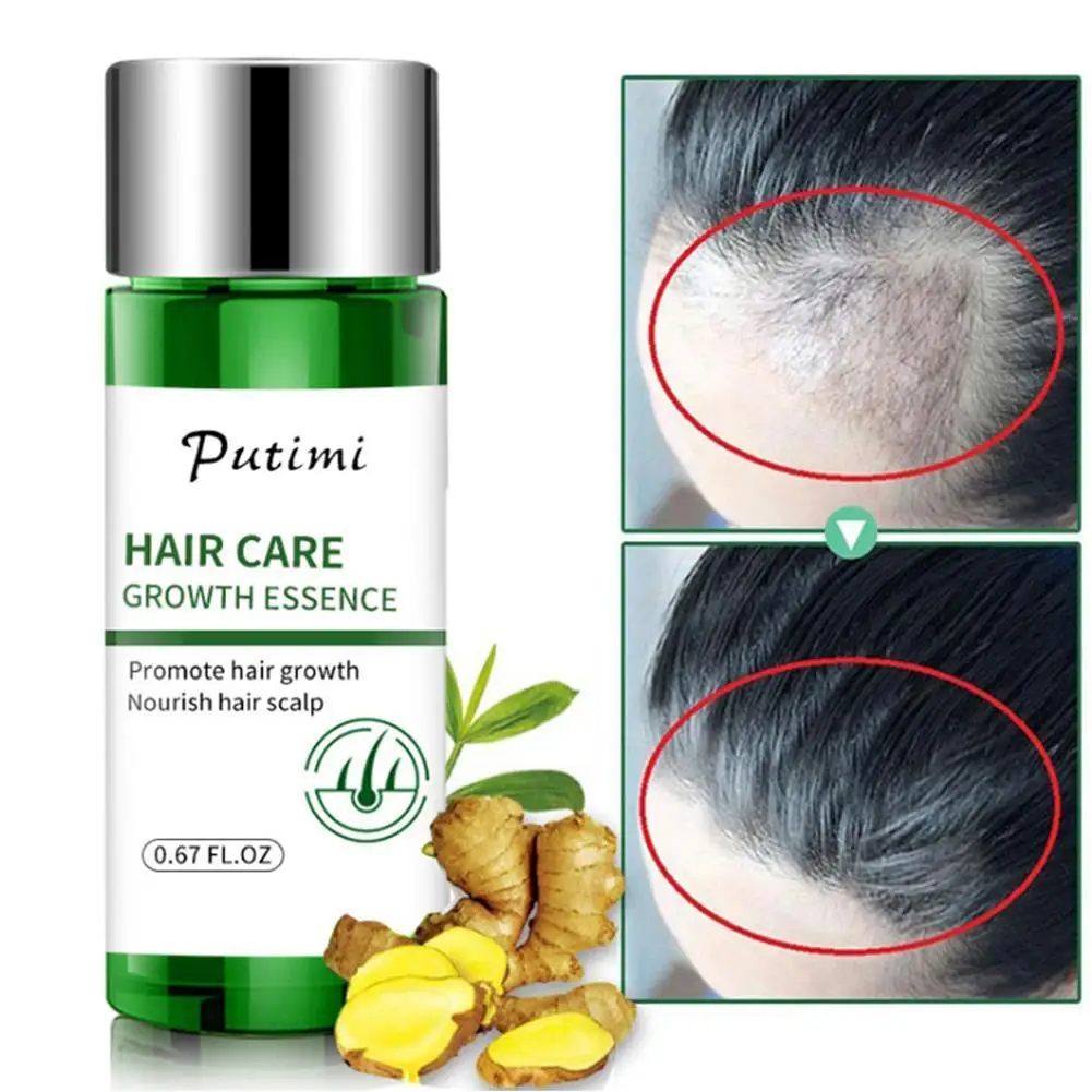 20ml Hair Growth Essential Oils Promote Hair Regrowth Care Hair Loss Serum Baldness Essence Hair Prevent Hair M5P5
20ml Hair Growth Essential Oils Promote Hair Regrowth Care Hair Loss Serum Baldness Essence Hair Prevent Hair M5P5