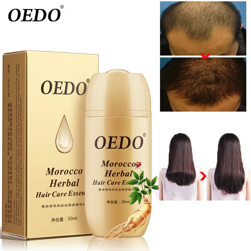 OEDO Morocco Essence Hairdressing Essential Oil Hair Care Oil Essential Oil Dry Damaged Hairs Nutrition
OEDO Morocco Essence Hairdressing Essential Oil Hair Care Oil Essential Oil Dry Damaged Hairs Nutrition