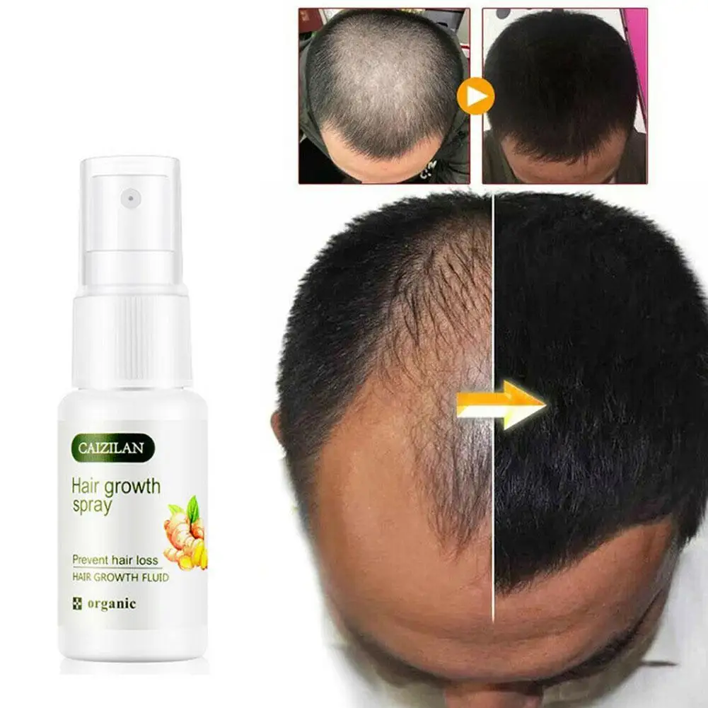 Ginger Nutrition Liquid Ginger Hair Root Spray 20ml Hair Conditioner Hair Spray Damaged Hair Repair Natural Hair Care Products
Ginger Nutrition Liquid Ginger Hair Root Spray 20ml Hair Conditioner Hair Spray Damaged Hair Repair Natural Hair Care Products