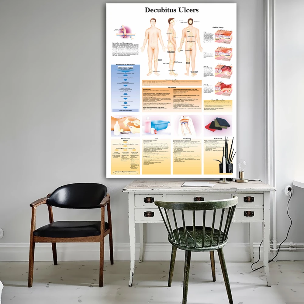 WANGART Decubitus Ulcers Chart Art Poster Print Body Map Canvas Wall Pictures for Medical Education Home Decor | Дом и сад