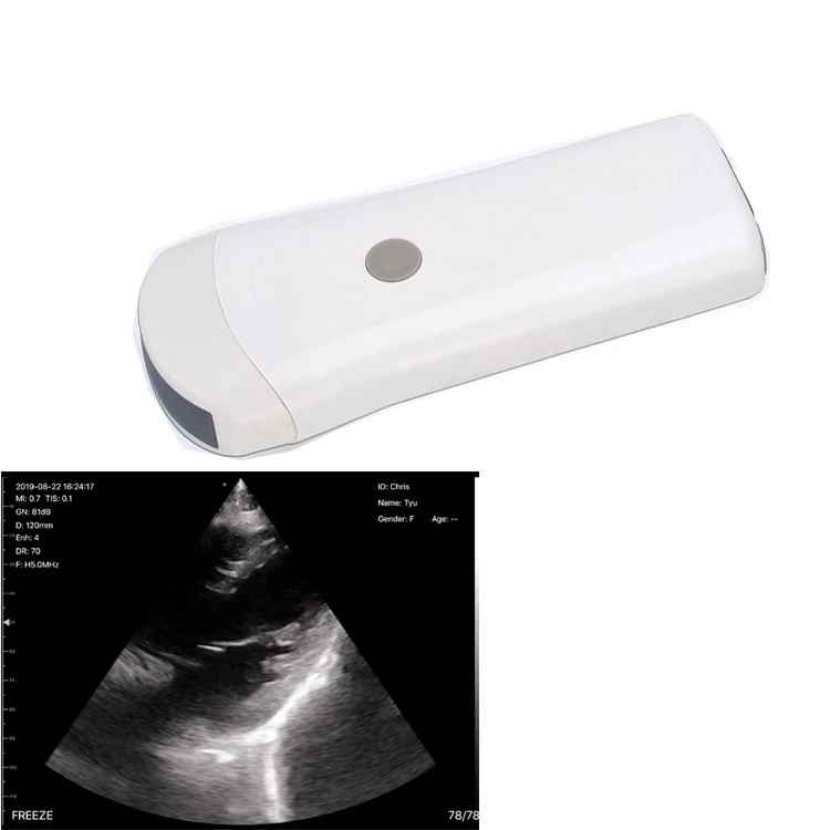 High Resolution Clear Images Ecograph Laptop Notebook Computer Color Doppler Usb Type C Linear Probe Portable Ultrasound
High Resolution Clear Images Ecograph Laptop Notebook Computer Color Doppler Usb Type C Linear Probe Portable Ultrasound