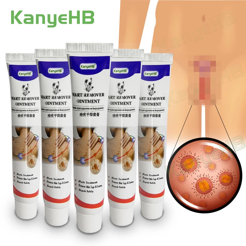5pcs Wart Remover Ointment Genital Herpes Genital Vulva Condyloma Acuminatum Skin Tag Remover Antibacterial Treatment Cream A637
5pcs Wart Remover Ointment Genital Herpes Genital Vulva Condyloma Acuminatum Skin Tag Remover Antibacterial Treatment Cream A637