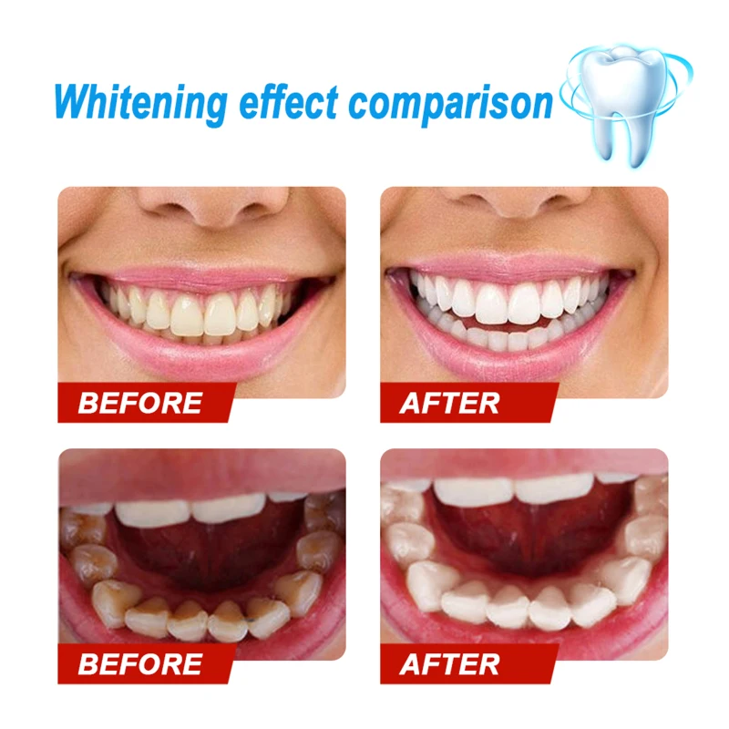 Eelhoe Teeth Whitening Powder Clean Oral Hygiene Whiten Remove Plaque Stains Fresh Breath Care Tools TSLM2 | Красота и здоровье