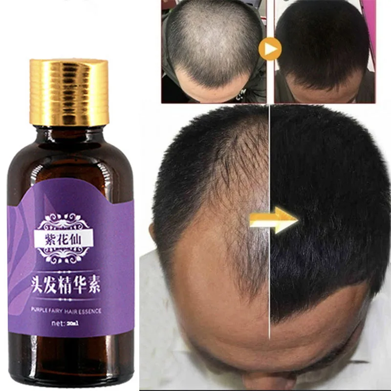 20ML Natural With No Side Effects Hair Care Essence Prevention Hair Loss Effective Fast Hair Growth Nourishes Oil Control Repair
20ML Natural With No Side Effects Hair Care Essence Prevention Hair Loss Effective Fast Hair Growth Nourishes Oil Control Repair
