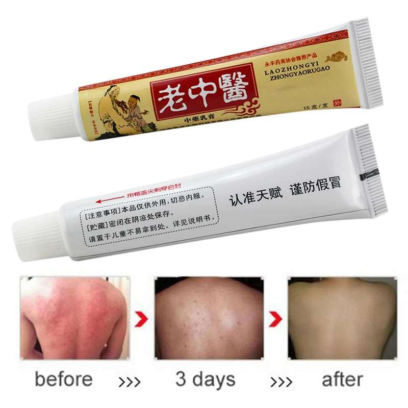 Psoriasis Cream Relieve Skin Discomfort for Dermatitis and Eczema Pruritus Psoriasis Ointment Antipruritic Creams Tube S
Psoriasis Cream Relieve Skin Discomfort for Dermatitis and Eczema Pruritus Psoriasis Ointment Antipruritic Creams Tube S