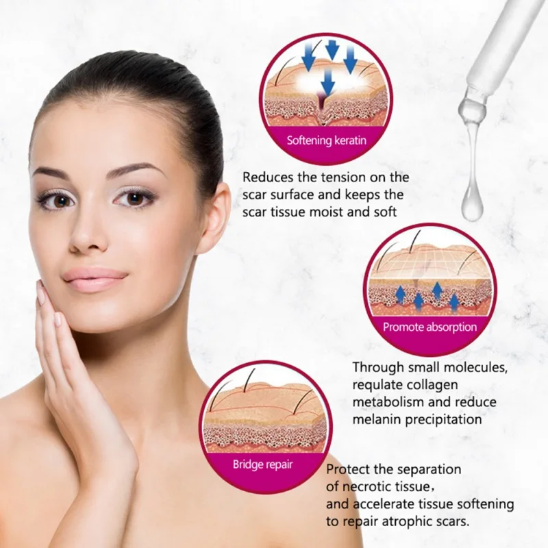 30 ml littekenherstel-essentie om acnelittekens te verwijderen en vlekken te vervagen. Acnebehandeling striae huidverzorging
30 ml littekenherstel-essentie om acnelittekens te verwijderen en vlekken te vervagen. Acnebehandeling striae huidverzorging