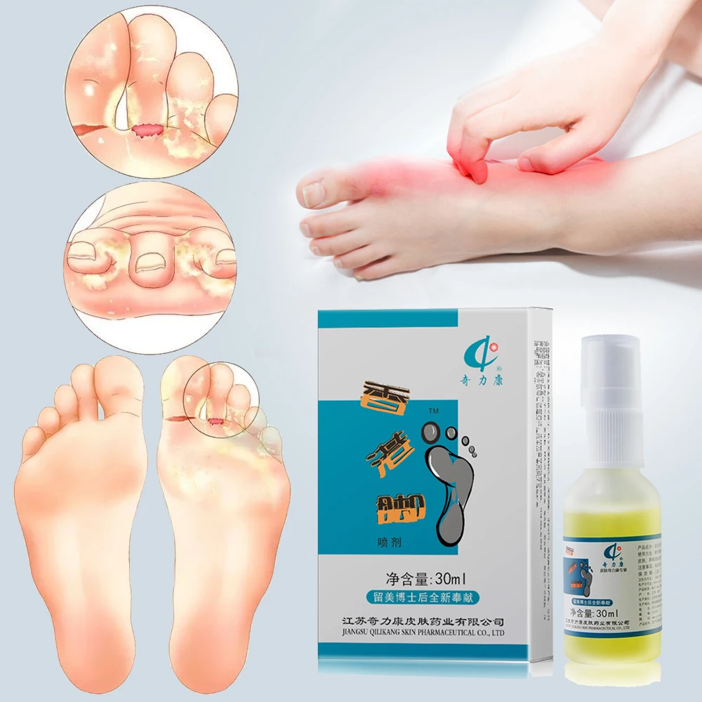 Foot Cream Foot Corn Removal Athlete's Erosive Beriberi Anti Itching Sweat Odor Feet Psoriasis Antibacterial Ointment
Foot Cream Foot Corn Removal Athlete's Erosive Beriberi Anti Itching Sweat Odor Feet Psoriasis Antibacterial Ointment