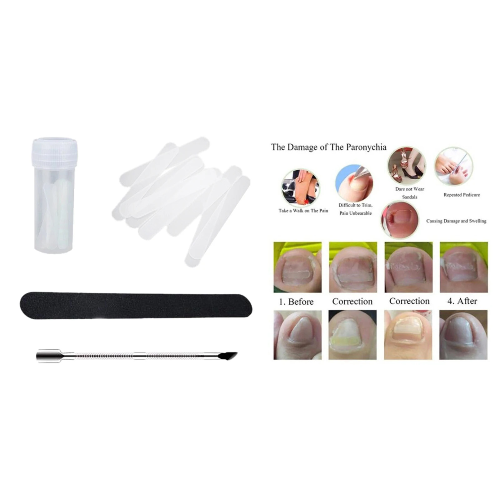 Инструменты для педикюра и вросших ногтей, изогнутый зажим для выпрямления ногтей на ногах, инструмент для коррекции паронихии 
Инструменты для педикюра и вросших ногтей, изогнутый зажим для выпрямления ногтей на ногах, инструмент для коррекции паронихии
