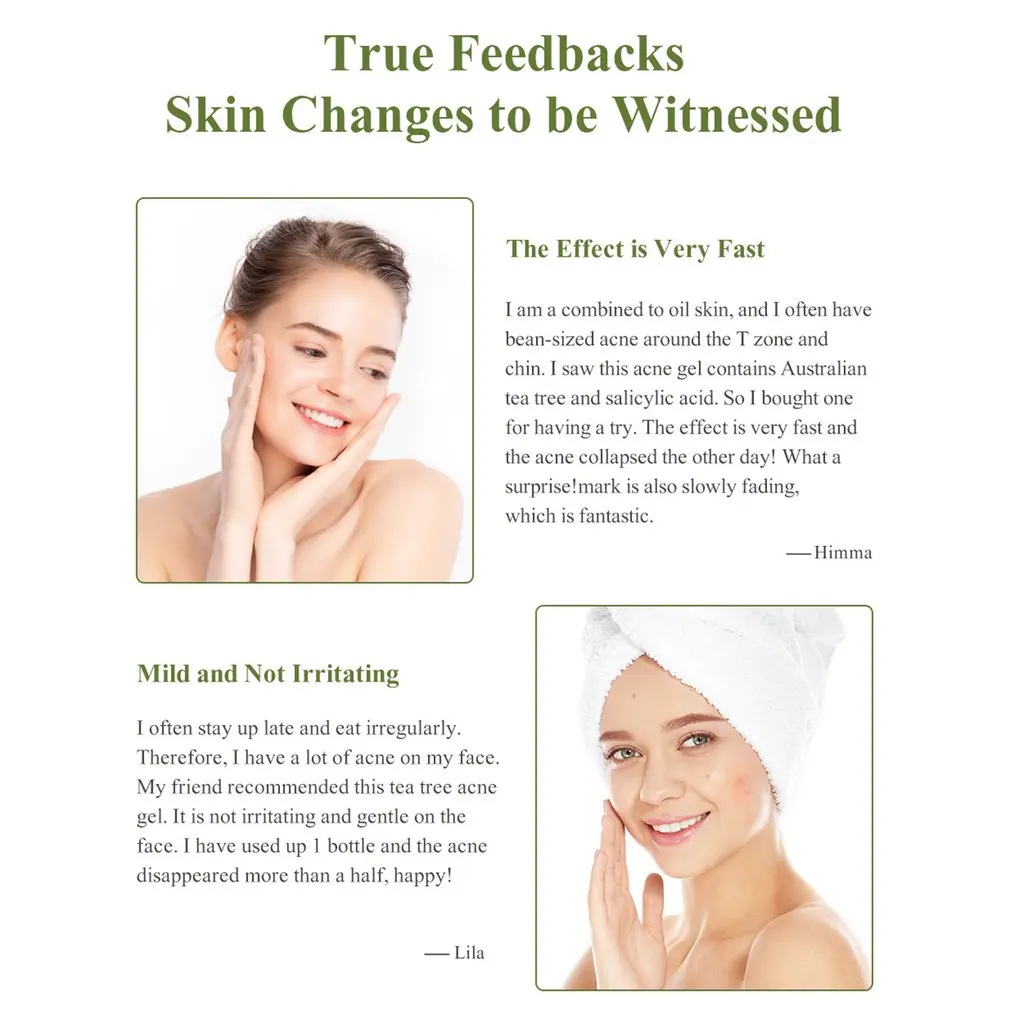 Pimples Removal Repair Cream Blain Treatment Gel Salicylic Acid Remove Anti Inflammation Face Shrink Pores Redness Skin Care 
Pimples Removal Repair Cream Blain Treatment Gel Salicylic Acid Remove Anti Inflammation Face Shrink Pores Redness Skin Care