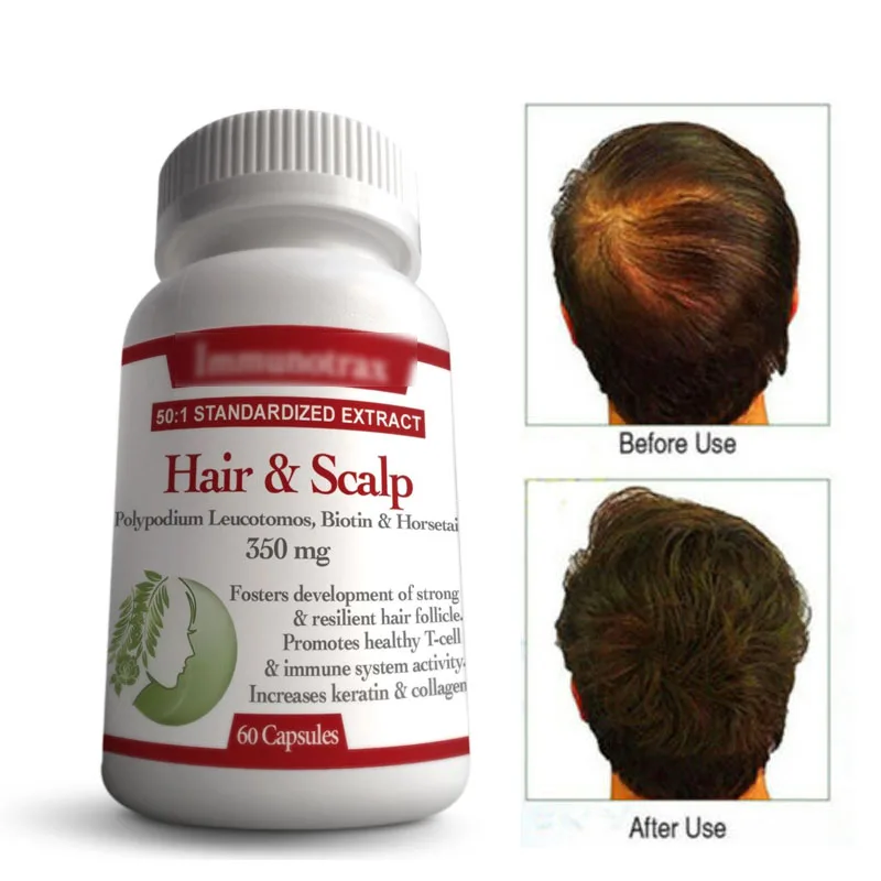 Biotin Increases Keratin Anti Hair Loss Alopecia Areata Hair & Scalp Repair Hair loss 60Caps/bottle
Biotin Increases Keratin Anti Hair Loss Alopecia Areata Hair & Scalp Repair Hair loss 60Caps/bottle