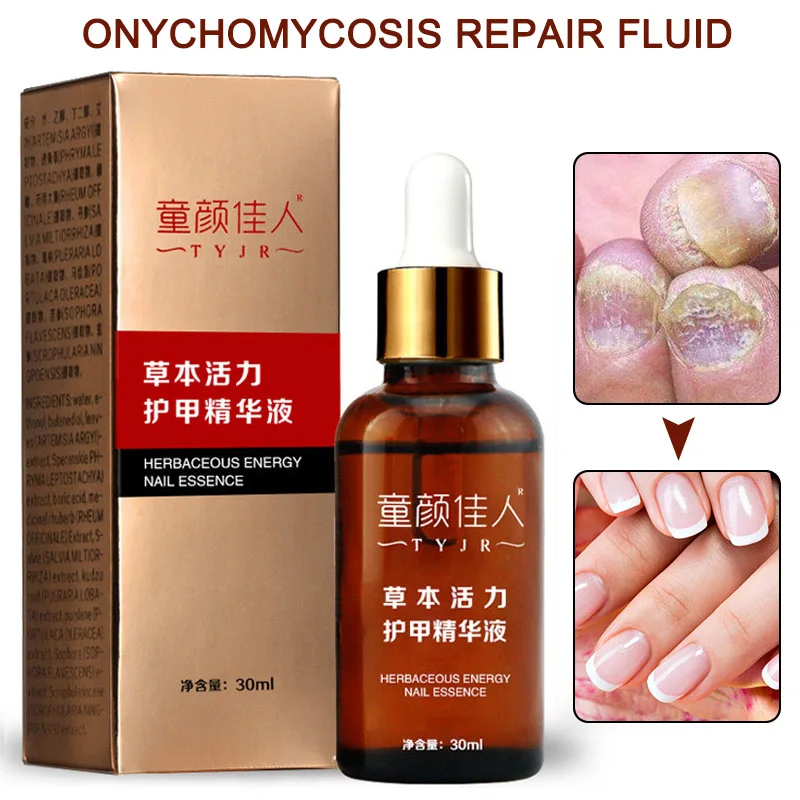 30ml Fungal Nail Treatment Nail Care Essence Anti Fungus Toe Nail Finger Infection Repair Liquid SOYW889 
30ml Fungal Nail Treatment Nail Care Essence Anti Fungus Toe Nail Finger Infection Repair Liquid SOYW889