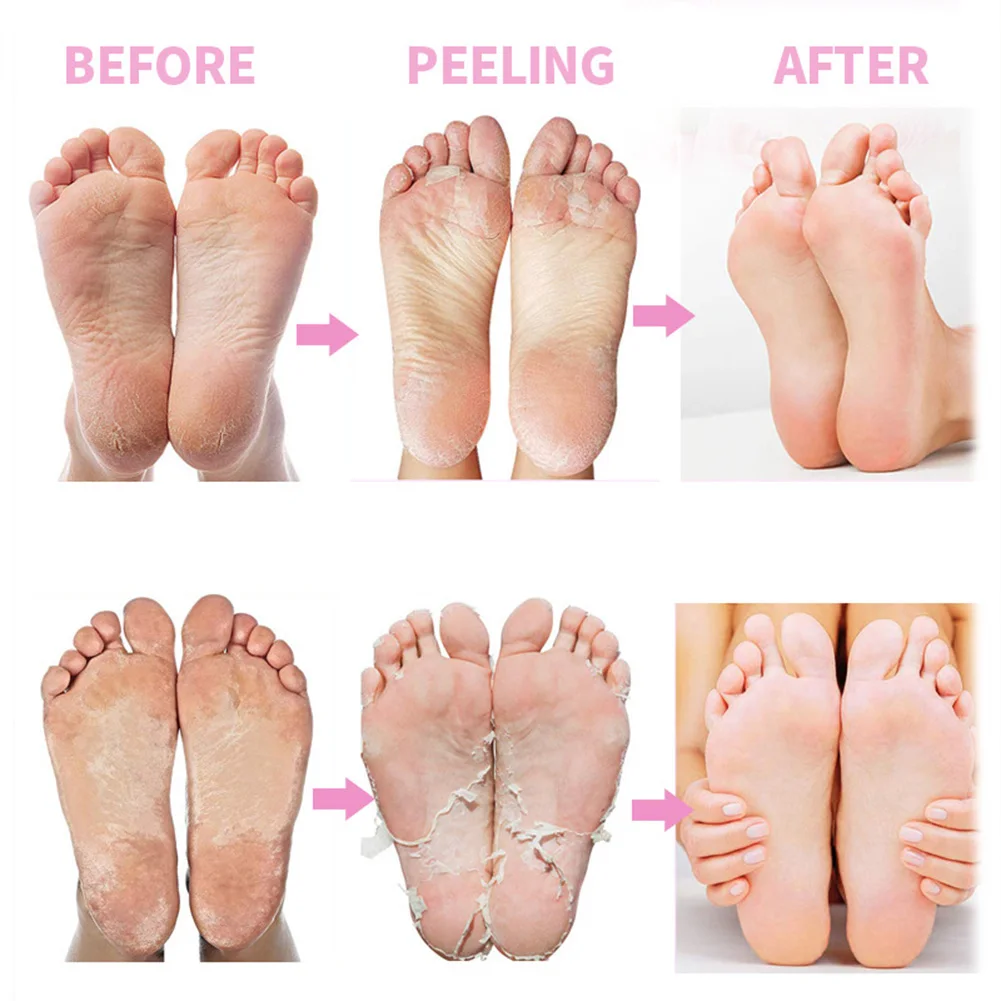 Exfoliating Feet Mask Exfoliating Foot Mask Socks Pedicure Peeling Dead Skin Remover Feet Mask Peel Foot Care Tool Moisturizing
Exfoliating Feet Mask Exfoliating Foot Mask Socks Pedicure Peeling Dead Skin Remover Feet Mask Peel Foot Care Tool Moisturizing