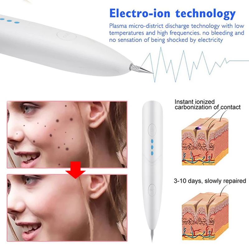 Ink Spot Eraser Skin Care Point Pen Mole Removal Dark Spot Remover Pen Skin Wart Tattoo Removal Tool USB Plasma Pen Beauty Care
Ink Spot Eraser Skin Care Point Pen Mole Removal Dark Spot Remover Pen Skin Wart Tattoo Removal Tool USB Plasma Pen Beauty Care