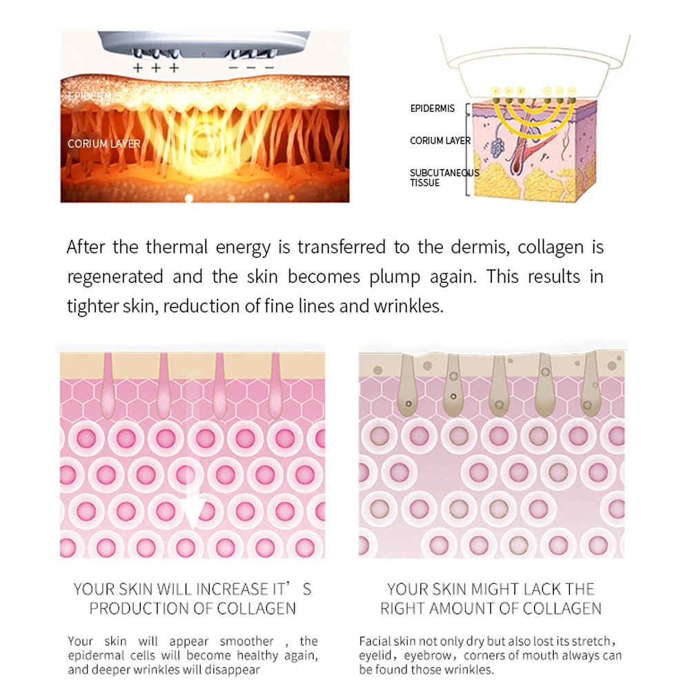 RF Radiofrequency Beauty Device Hot Warm Treatment Skin Rejuvenation Wrinkle Remover Facial Massage Lifting Tool
RF Radiofrequency Beauty Device Hot Warm Treatment Skin Rejuvenation Wrinkle Remover Facial Massage Lifting Tool