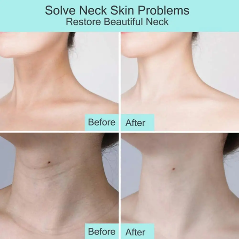 Beauty Neck Cream Double Scroll Wheel Reduce Neck Wrinkles Hazel V-shaped Witch Firming Care Neck Lifting Massage Fullerene G5L3
Beauty Neck Cream Double Scroll Wheel Reduce Neck Wrinkles Hazel V-shaped Witch Firming Care Neck Lifting Massage Fullerene G5L3