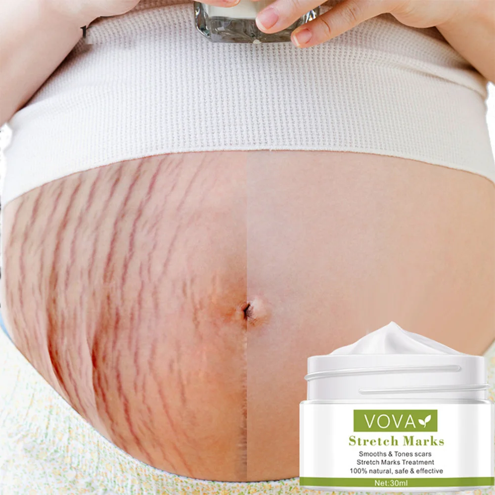 Remove Pregnancy Scars Treatment Maternity Acne Cream Stretch Marks Effective Repair Anti Aging Anti Winkles Firming Body Creams
Remove Pregnancy Scars Treatment Maternity Acne Cream Stretch Marks Effective Repair Anti Aging Anti Winkles Firming Body Creams