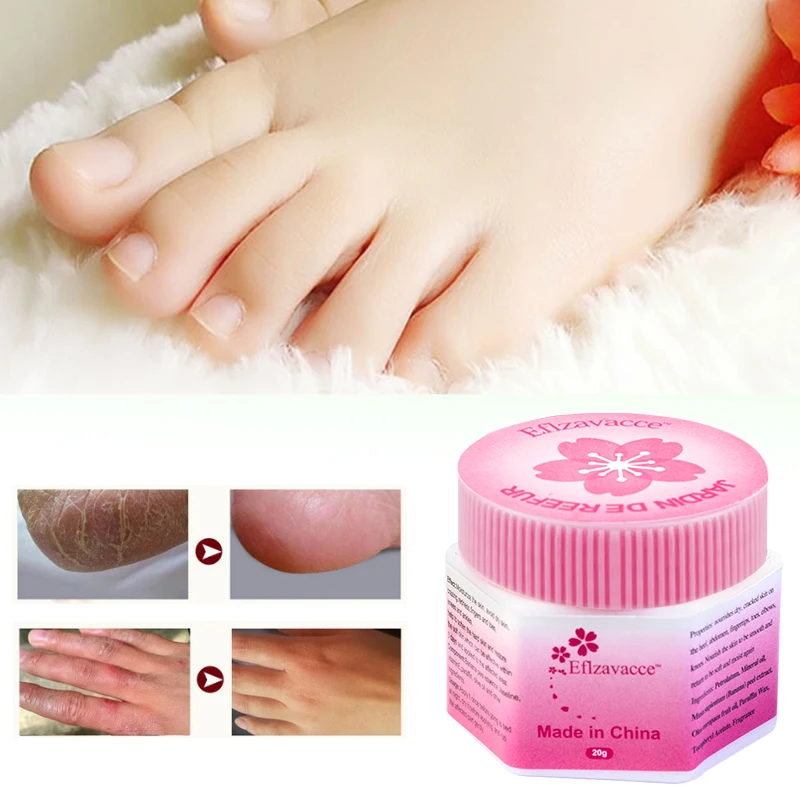 20g Banana Cherry Oil Foot Cream Dead Skin Remover Repair Moisturizing Whitening Exfoliating Anti-dry Ageless Foot Crack Cream
20g Banana Cherry Oil Foot Cream Dead Skin Remover Repair Moisturizing Whitening Exfoliating Anti-dry Ageless Foot Crack Cream