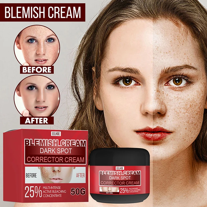 50g Whitening Freckle Cream Remove Melasma Acne Spot Pigment Melanin Dark Spots Pigmentation Moisturizing Gel Skin Care
50g Whitening Freckle Cream Remove Melasma Acne Spot Pigment Melanin Dark Spots Pigmentation Moisturizing Gel Skin Care