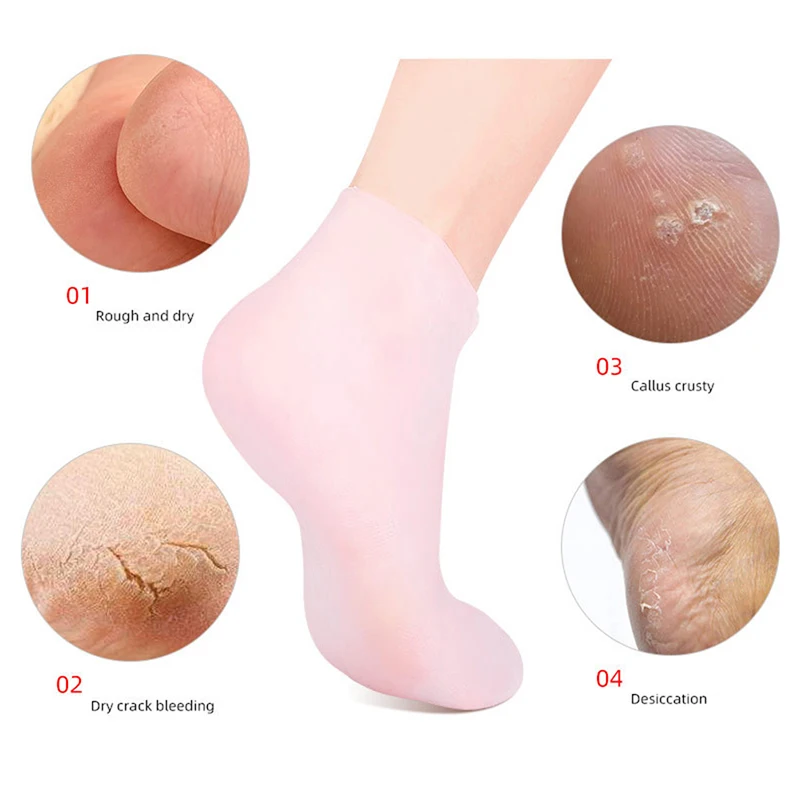 Exfoliating And Preventing Dryness Cracked Dead Skin Remove Protector Pain Relief Tools Silicone Moisturizing Spa Gel Heel Socks
Exfoliating And Preventing Dryness Cracked Dead Skin Remove Protector Pain Relief Tools Silicone Moisturizing Spa Gel Heel Socks