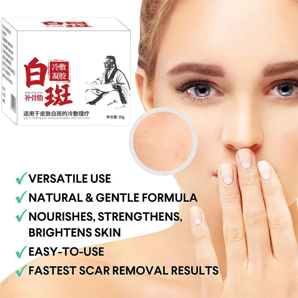 30ml White Spot Antibacterial Spray 30g Vitiligo Treatment Cream Leukoplakia Disease Promoting Pigment Melanin Skin Care Supply
30ml White Spot Antibacterial Spray 30g Vitiligo Treatment Cream Leukoplakia Disease Promoting Pigment Melanin Skin Care Supply