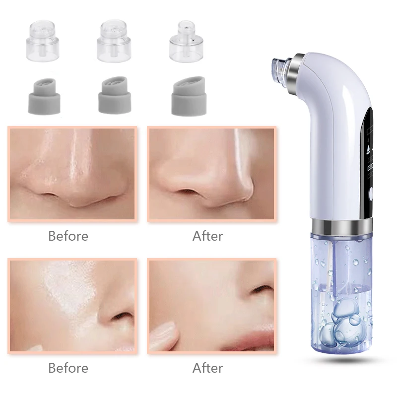 Blackhead Remover Nose Face Deep Cleaner Pore Acne Pimple Removal Vacuum Suction Facial Beauty Clean Skin Tool
Blackhead Remover Nose Face Deep Cleaner Pore Acne Pimple Removal Vacuum Suction Facial Beauty Clean Skin Tool