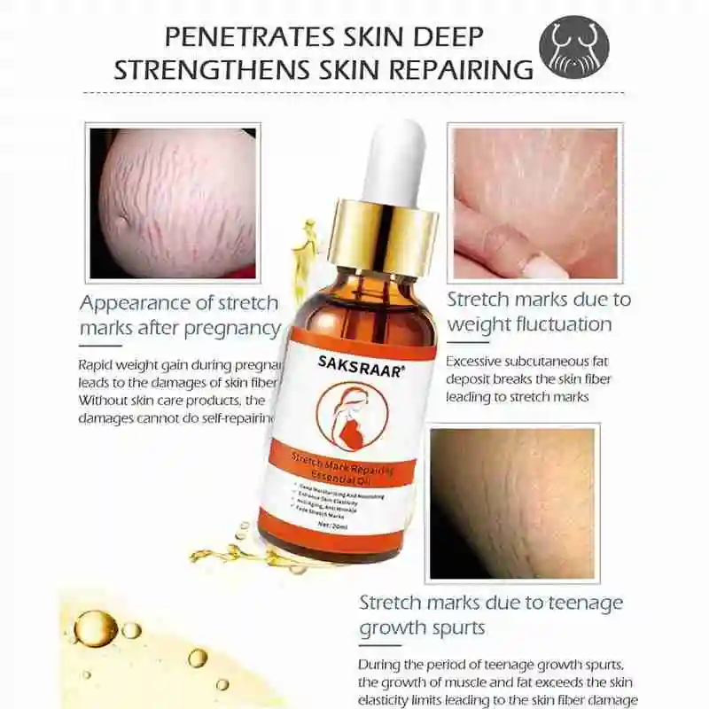 20ml Powerful Removal Stretch Marks Essential Oil Pregnancy Repair Skin Smooth Scar Body Maternity Hot Removal Cream
20ml Powerful Removal Stretch Marks Essential Oil Pregnancy Repair Skin Smooth Scar Body Maternity Hot Removal Cream