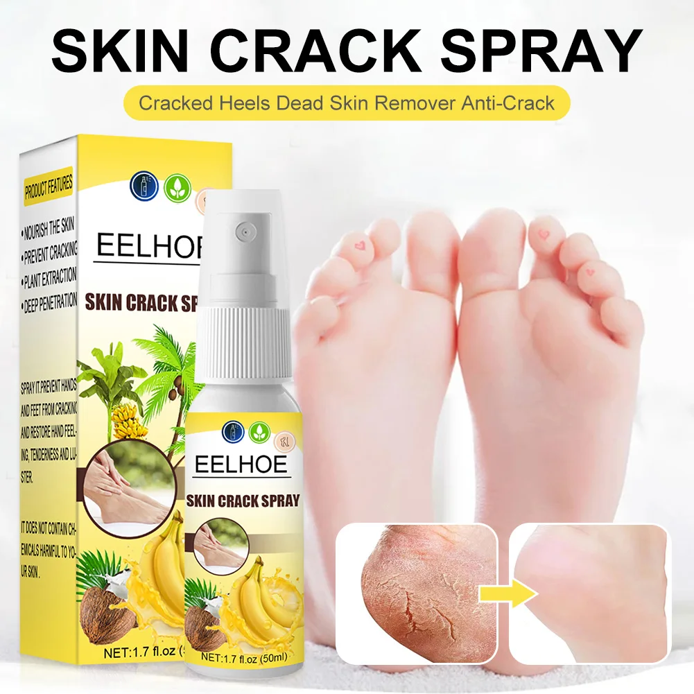50ml Foot Care Spray Natural Banana Coconut Foot Repair Spray Cracked Heels Dead Skin Remover Anti-Crack Foot Moisturizing Spray
50ml Foot Care Spray Natural Banana Coconut Foot Repair Spray Cracked Heels Dead Skin Remover Anti-Crack Foot Moisturizing Spray
