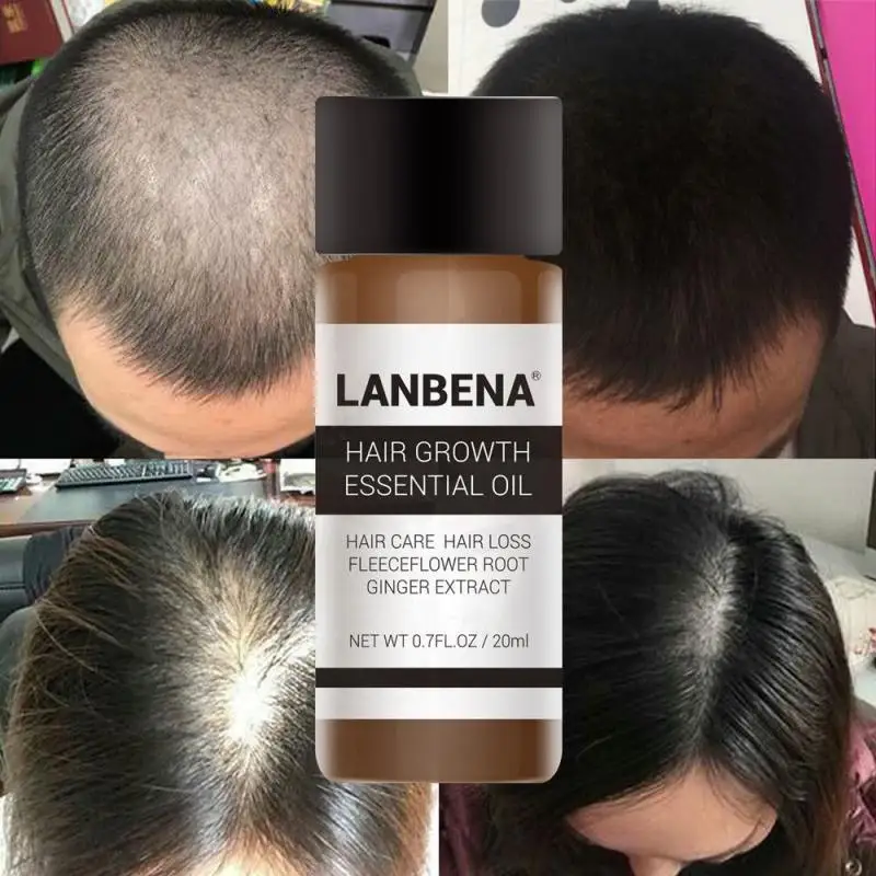 Эфирное масло для ухода за волосами LANBENA, быстрорастущее средство против выпадения, жидкий экстракт корня Имбиря из флиса TSLM1
Эфирное масло для ухода за волосами LANBENA, быстрорастущее средство против выпадения, жидкий экстракт корня Имбиря из флиса TSLM1