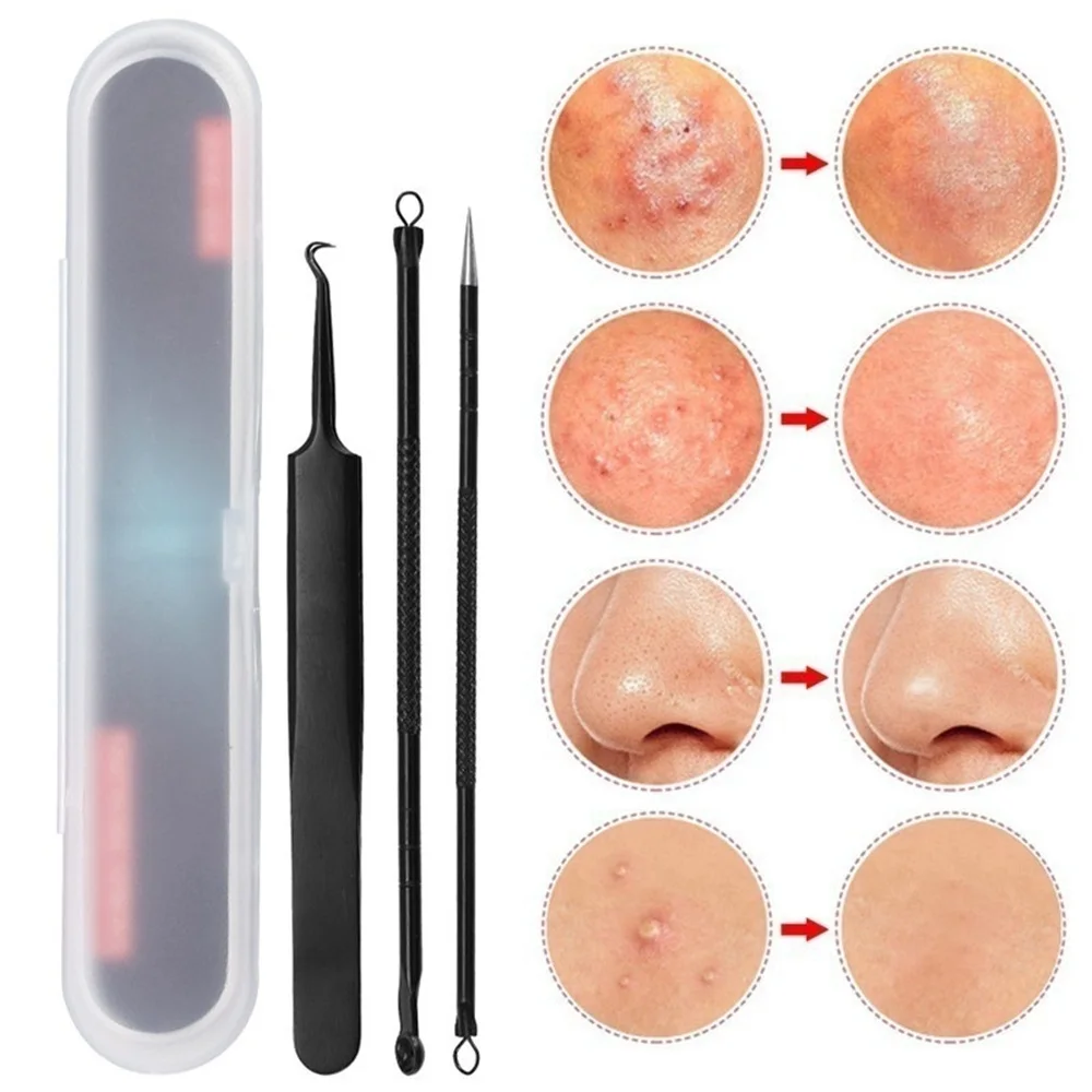 3PCS Blackhead Extractor Cleaner Acne Blemish Remover Needles Set Stainless Black Spots Face Pore Facial Cleanser Tools
3PCS Blackhead Extractor Cleaner Acne Blemish Remover Needles Set Stainless Black Spots Face Pore Facial Cleanser Tools