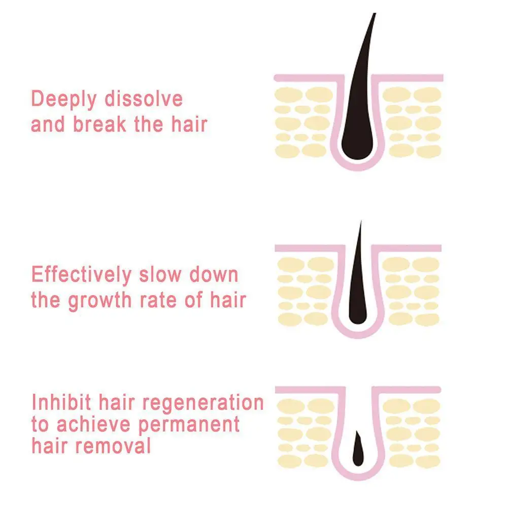 Пенообразующий крем для удаления волос X3Y1, спрей для тела, не вызывает раздражения, не вызывает боли в бикини
Пенообразующий крем для удаления волос X3Y1, спрей для тела, не вызывает раздражения, не вызывает боли в бикини