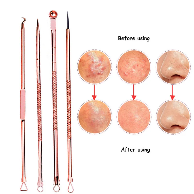 Efero 4Pcs Double-Ended Stainless Steel Blackhead Pimples Acne Needle Rose Gold Acne Extractor Remover Tool Skin Care
Efero 4Pcs Double-Ended Stainless Steel Blackhead Pimples Acne Needle Rose Gold Acne Extractor Remover Tool Skin Care