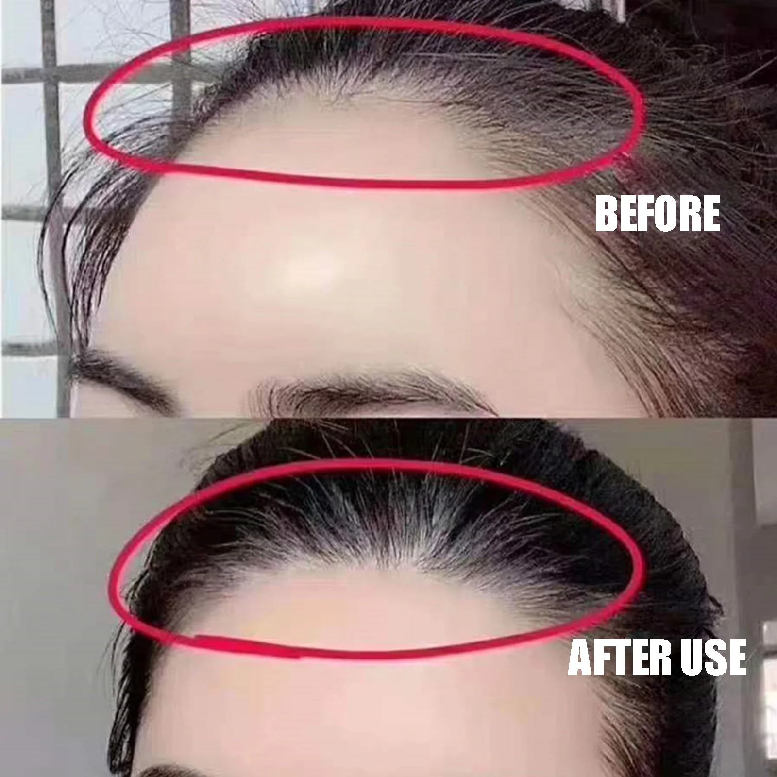 20ml Hair Line Growth Derma Scalp Intensive Ampoule Hair Fast Roll Triple Massager Essence Loss Regrow Hair
20ml Hair Line Growth Derma Scalp Intensive Ampoule Hair Fast Roll Triple Massager Essence Loss Regrow Hair