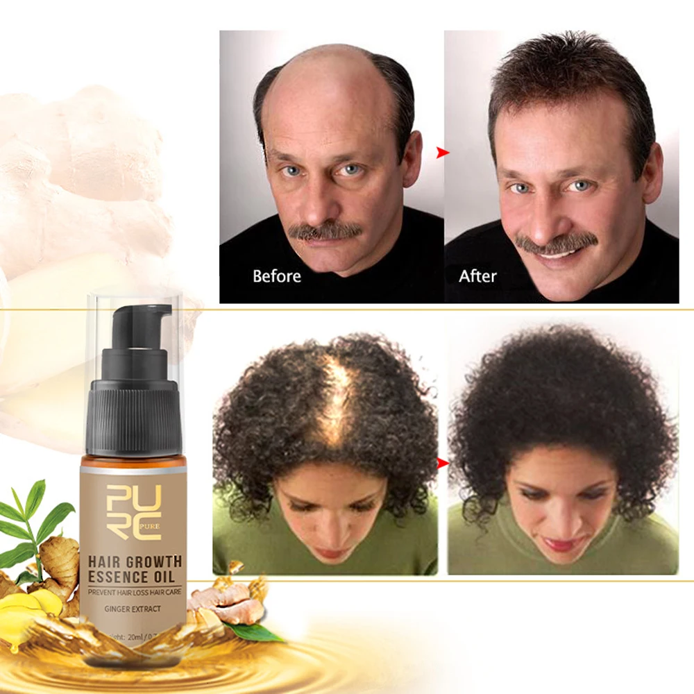 Hair Growth Spray Hair Loss Treatment Fast Grow Hair Nourishing Cure Scalp Root For Thinning Hair Hair Care 20ml
Hair Growth Spray Hair Loss Treatment Fast Grow Hair Nourishing Cure Scalp Root For Thinning Hair Hair Care 20ml