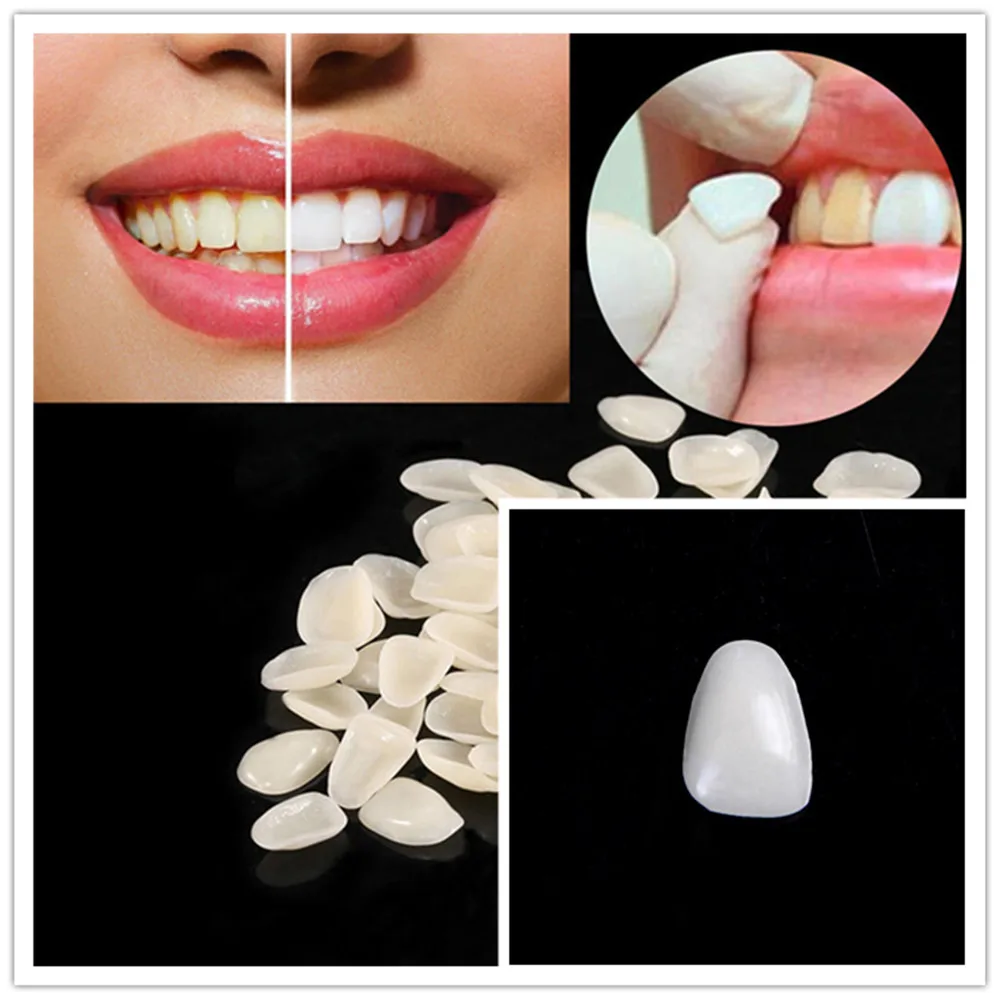 New 50pcs Crown Ultra-Thin Tooth Patch Resin Temporary Teeth For Anterior Teeth Veneers Provisionals Teeth Beauty
New 50pcs Crown Ultra-Thin Tooth Patch Resin Temporary Teeth For Anterior Teeth Veneers Provisionals Teeth Beauty