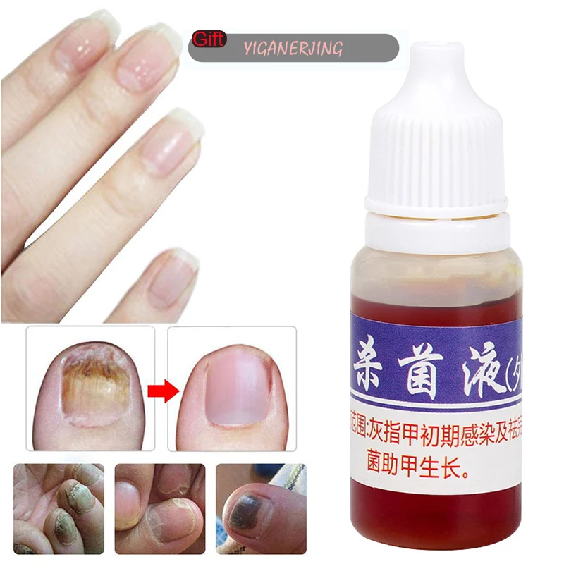 Nail Cuticle Oil Repair Fungal Nail Treatment Remove Toe Onychomycosis Remover Serum Nail Repair Treatment for Health Skin Care
Nail Cuticle Oil Repair Fungal Nail Treatment Remove Toe Onychomycosis Remover Serum Nail Repair Treatment for Health Skin Care