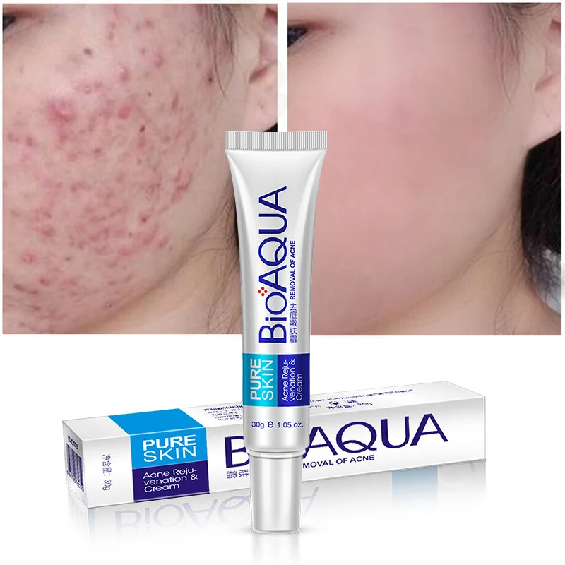 Effective Acne Treatment Face Cream Anti-Acne Repair Fade Acne Spots Oil Control Moisturizer Whitening Cosmetic Beauty Skin Care
Effective Acne Treatment Face Cream Anti-Acne Repair Fade Acne Spots Oil Control Moisturizer Whitening Cosmetic Beauty Skin Care