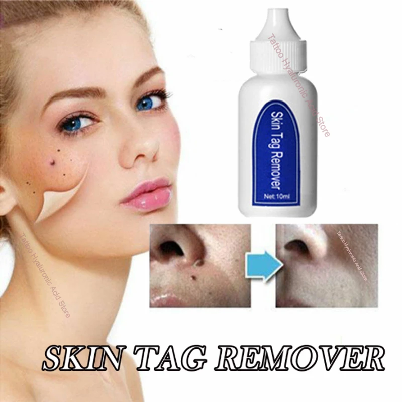Dark Spot Home Solution Painless No Harm Foot Corn Skin Tag Remover Serum Wart Professional Liquid Mole Portable Freckle 10ml
Dark Spot Home Solution Painless No Harm Foot Corn Skin Tag Remover Serum Wart Professional Liquid Mole Portable Freckle 10ml