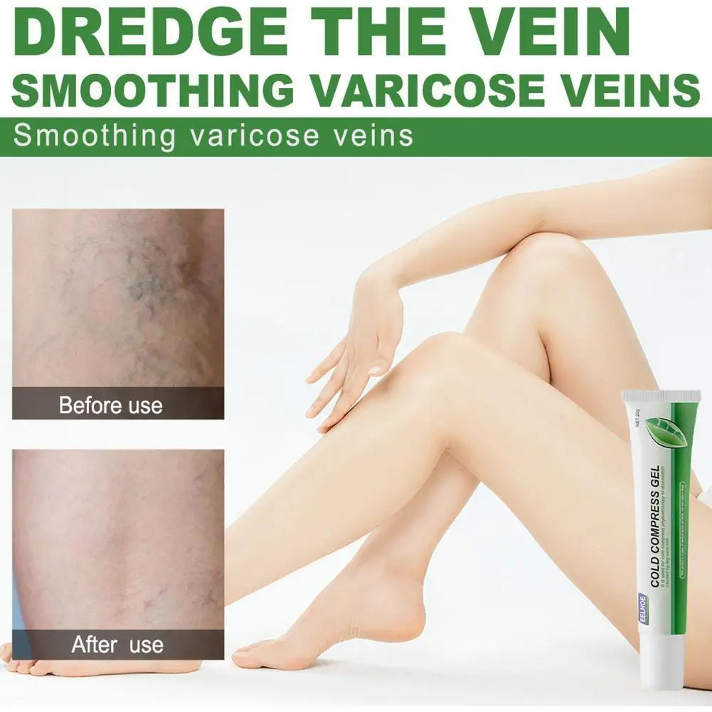 1pc 20g Varicose Vein Cold Compress Gel Phlebitis Vasculitis Swelling Relief Leg Pain Treatment Angiitis Care Varicosity Oint
1pc 20g Varicose Vein Cold Compress Gel Phlebitis Vasculitis Swelling Relief Leg Pain Treatment Angiitis Care Varicosity Oint
