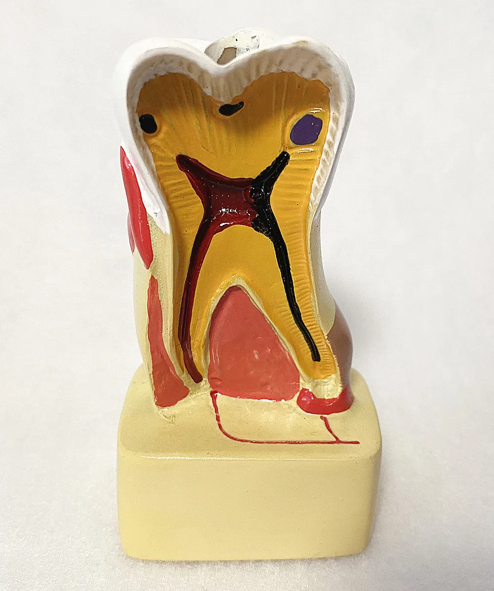 1x Dental Single Pc Backteeth Molars Posterior Teeth Tissue Anatomical Study Teach Model
1x Dental Single Pc Backteeth Molars Posterior Teeth Tissue Anatomical Study Teach Model