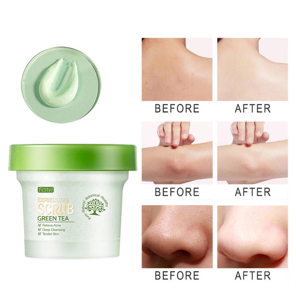 100g Green Tea Exfoliating Facial Scrub Deep Cleansing Relieve Acne Blackhead Whitening Shrink Pores Tender Skin Body Scrub
100g Green Tea Exfoliating Facial Scrub Deep Cleansing Relieve Acne Blackhead Whitening Shrink Pores Tender Skin Body Scrub