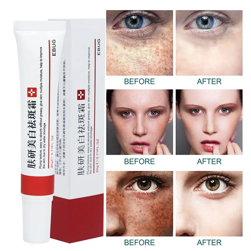 Whitening Freckle Cream Remove Melasma Cream Remove Dark Spots Melanin Melasma Remover Brighten Skin Anti-Aging Skin Lightening
Whitening Freckle Cream Remove Melasma Cream Remove Dark Spots Melanin Melasma Remover Brighten Skin Anti-Aging Skin Lightening