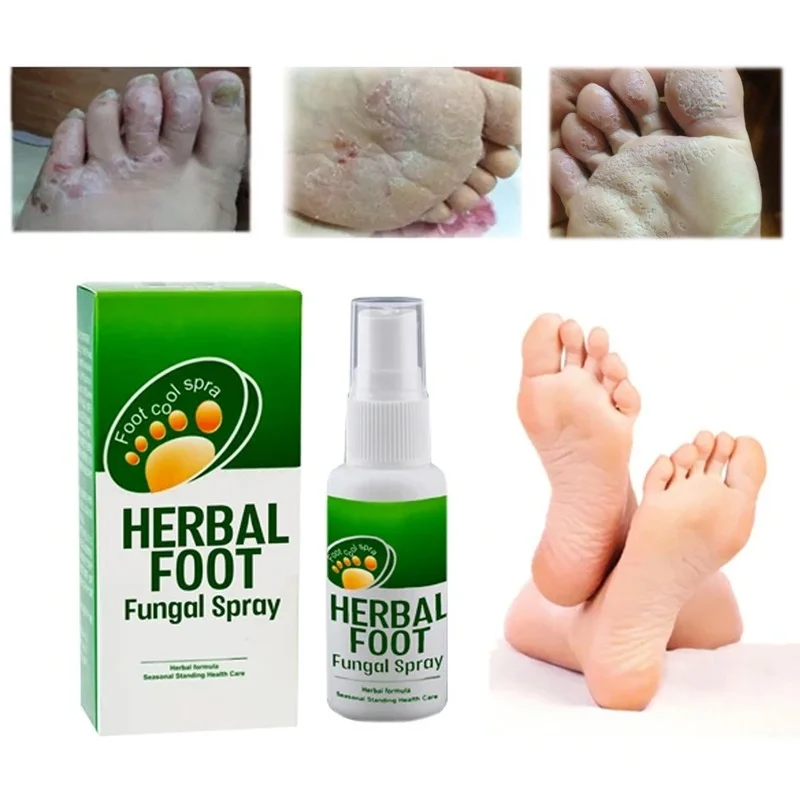 Deodorant Footwear Deodorant Antibacterial Spray Foot Onychomycosis Athlete Foot Itchy Foot Peeling Spray Foot Skin Care
Deodorant Footwear Deodorant Antibacterial Spray Foot Onychomycosis Athlete Foot Itchy Foot Peeling Spray Foot Skin Care