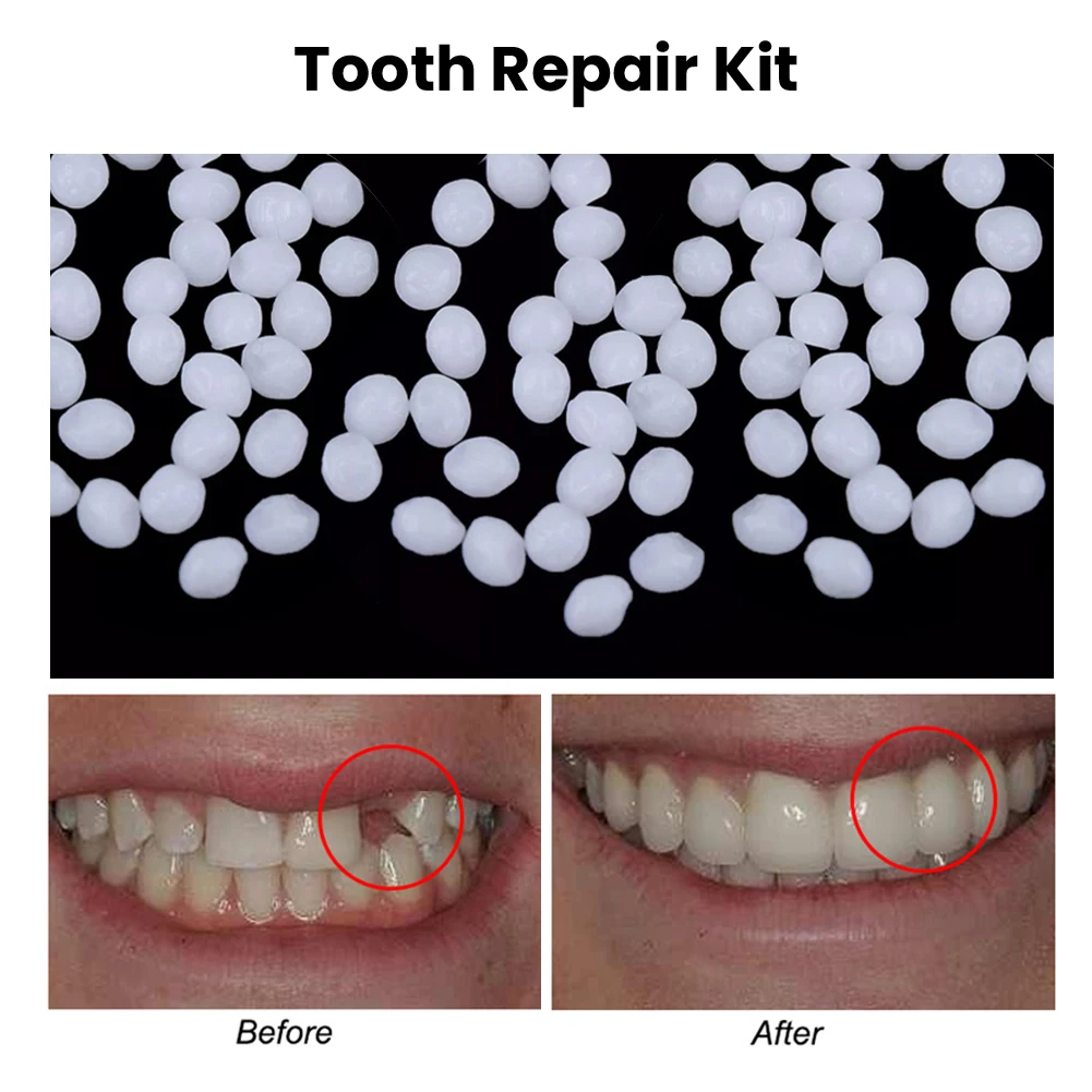 10g/50g/100g Repair Kit Denture Solid Dental Teeth Dental Restoration Temporary Solid Denture Adhesive Teeth And Fills Gaps
10g/50g/100g Repair Kit Denture Solid Dental Teeth Dental Restoration Temporary Solid Denture Adhesive Teeth And Fills Gaps