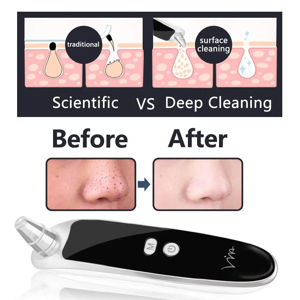 Blackhead Remover Electric Face Cleaner Ultrasonic Blackheads Clean Pores Machine
Blackhead Remover Electric Face Cleaner Ultrasonic Blackheads Clean Pores Machine