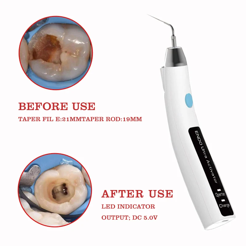 Dental Endodontic Ultrasonic Activator Cordless LED Endo Irrigator Handpiece +6 Tips Root Canal Treatment Dentistry Endo File
Dental Endodontic Ultrasonic Activator Cordless LED Endo Irrigator Handpiece +6 Tips Root Canal Treatment Dentistry Endo File
