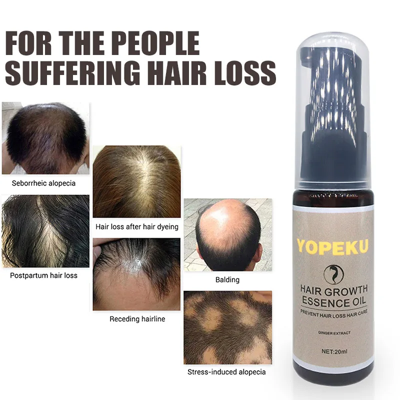 Hair Loss Products and Fast Hair Growth Remedy Essence Oil Natural Extracts Liquid Hair Regrowth Products Treatment Solutions
Hair Loss Products and Fast Hair Growth Remedy Essence Oil Natural Extracts Liquid Hair Regrowth Products Treatment Solutions