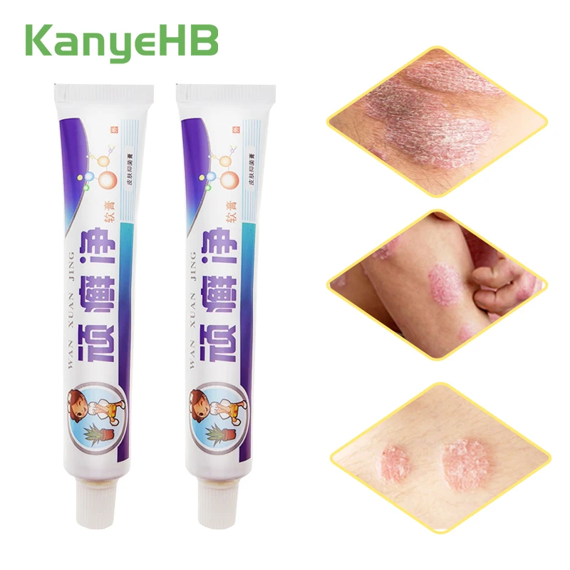 2pcs Treatment Psoriasis Cream Bacteriostasis Eczema Dermatitis Anti-inflammatory Pruritus Antipruritic Eczematoid Ointment
2pcs Treatment Psoriasis Cream Bacteriostasis Eczema Dermatitis Anti-inflammatory Pruritus Antipruritic Eczematoid Ointment