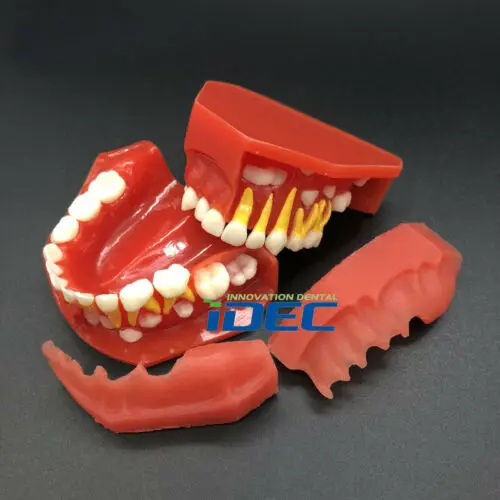 Dental Model Children Primary Teeth Pediatric Model 3-6y Demonstration 1PC
Dental Model Children Primary Teeth Pediatric Model 3-6y Demonstration 1PC