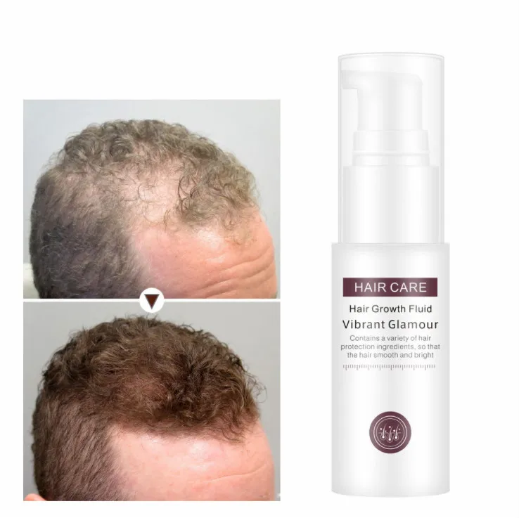 Effective Result Hair Loss Product Series Oil Dry And Damaged Hairs Fast Hair Growth Serum Oil 100% Natural Extract TSLM1
Effective Result Hair Loss Product Series Oil Dry And Damaged Hairs Fast Hair Growth Serum Oil 100% Natural Extract TSLM1